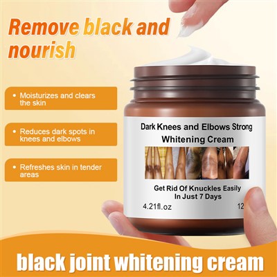 Dark Knees and Elbows Strong Whitening Cream