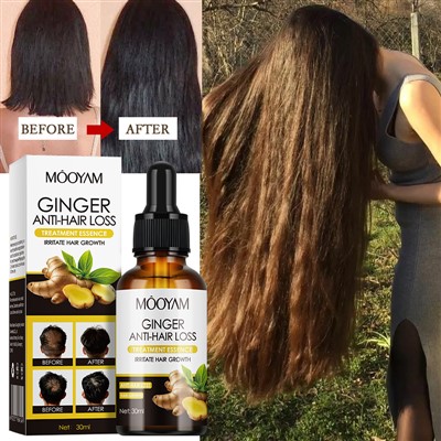 Ginger Anti-Hair Loss Treatment Essence
