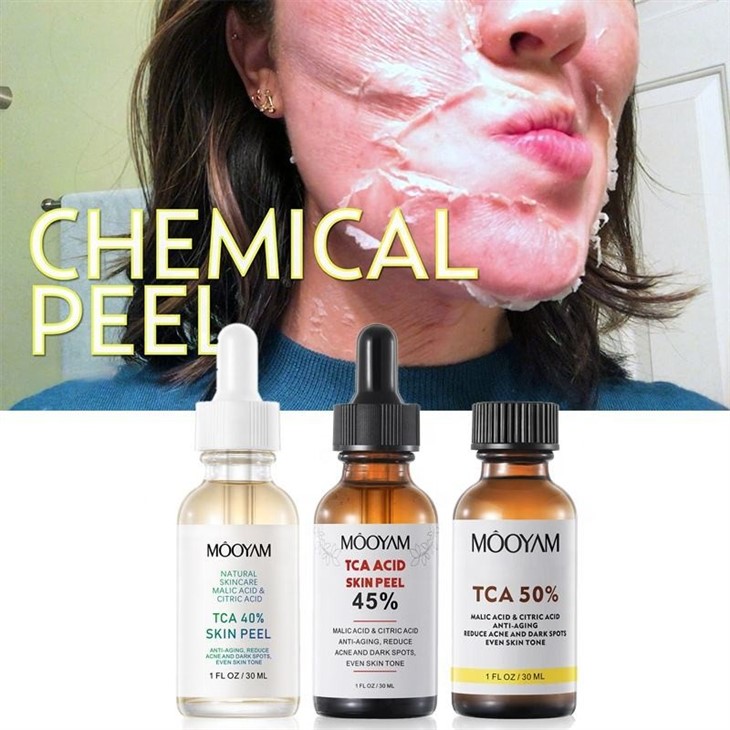 TCA Skin Peel Serum