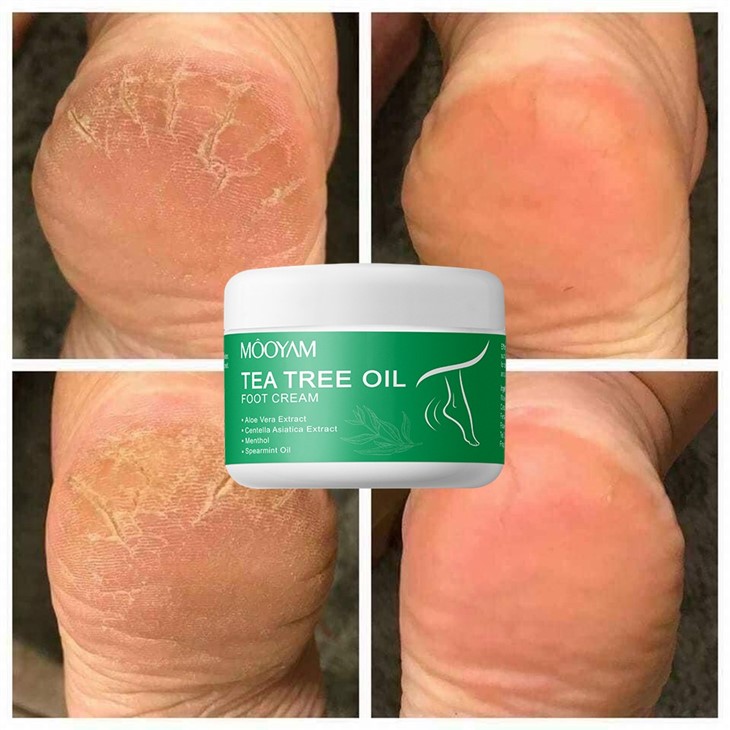 Tea Tree Oil Foot Cream