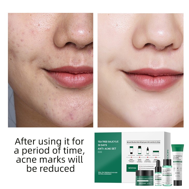 Tea Tree Salicylic 30days Anti-Acne Skincare Set