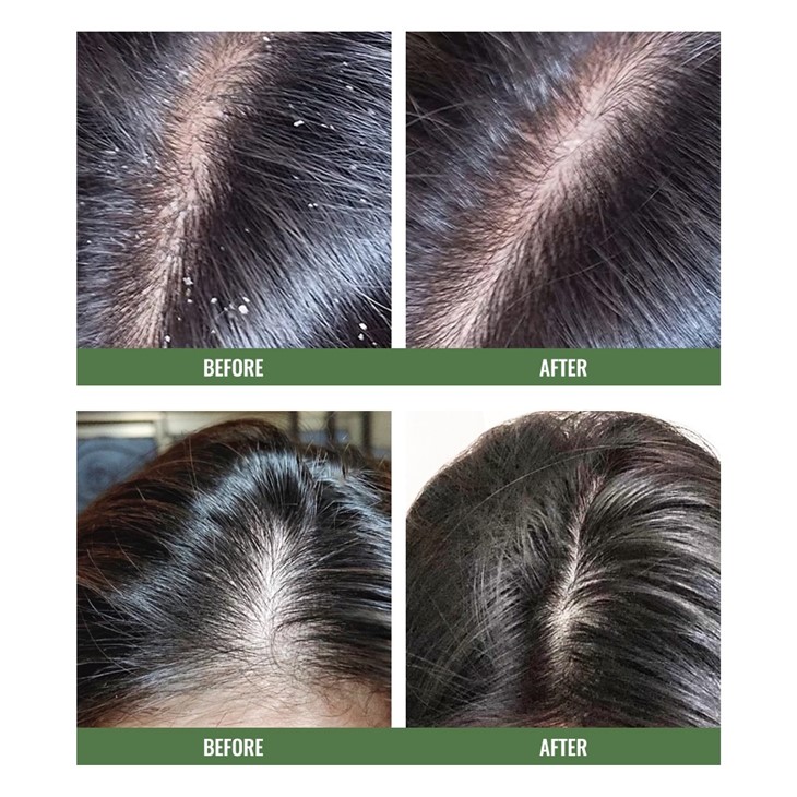 Tea Tree Shampoo