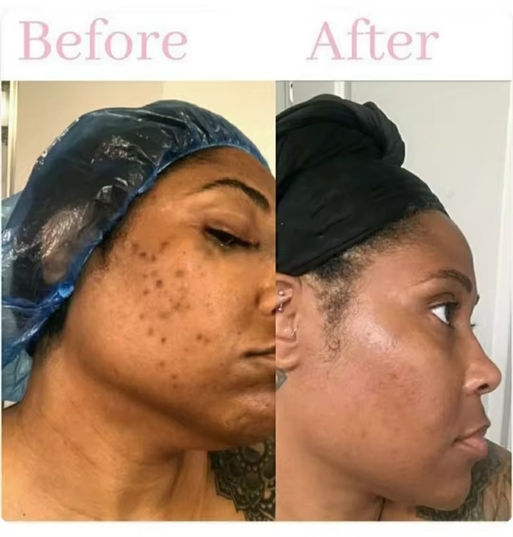 Turmeric Face Toner