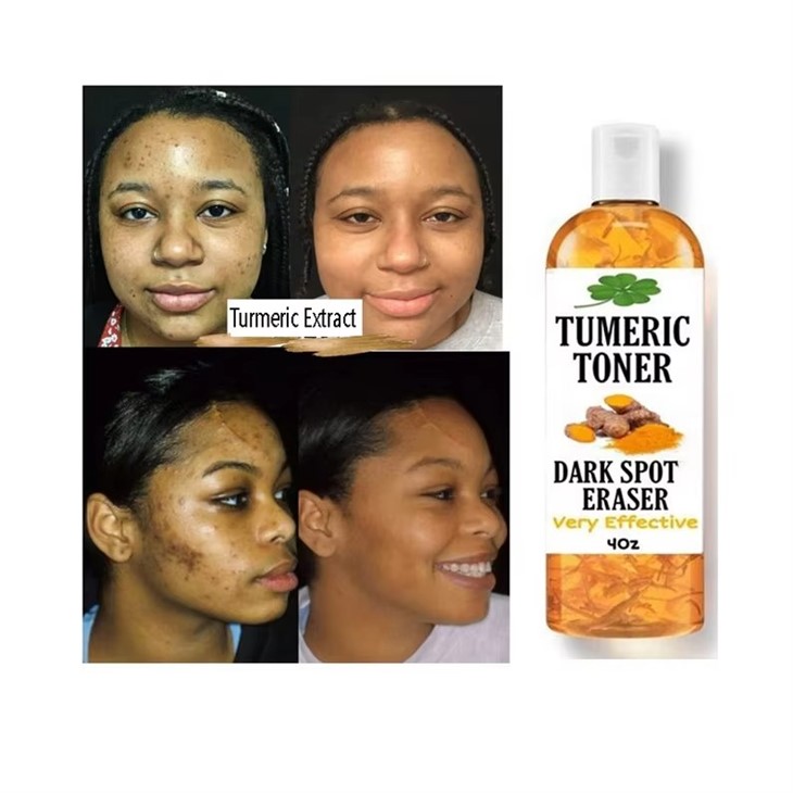 Turmeric Face Toner