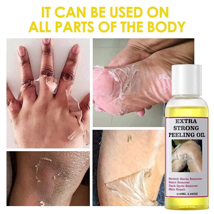 Yellow Strong Peeling Oil