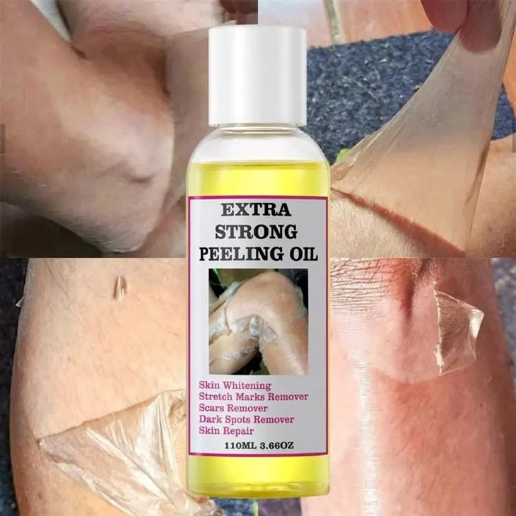 Yellow Strong Peeling Oil
