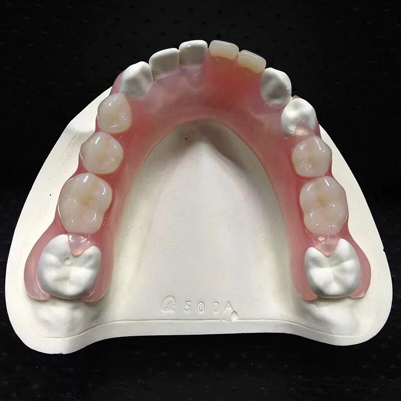 Proteză de Valplast parțial bilateral dentar