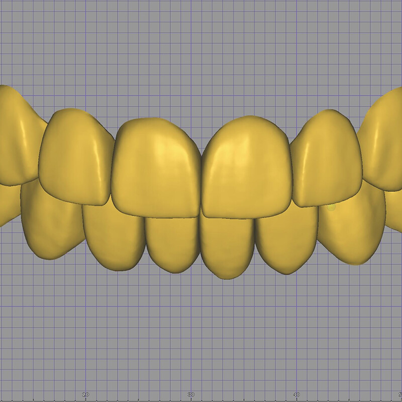 Dantų skaitmeninis mulidvitų faneros dizainas