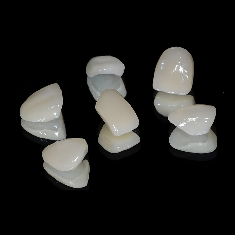 Fuljetta tad-dentali tal-porċellana sħiħa tal-arkata emax