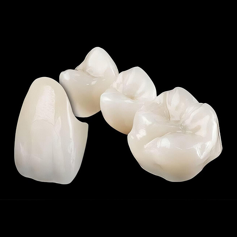 दंत पूर्ण समोच्च जिरकोनिया क्राउन