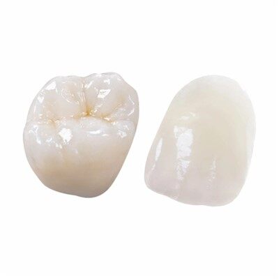 Buccal gốm IPS EMAX Crown