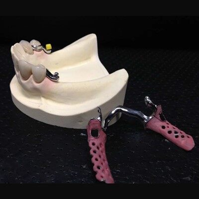 Tannkúlukúlur nákvæmni viðhengi