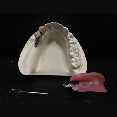 Стоматологічний болт на точній кріпленні