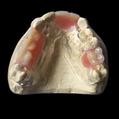 Tannlækningar tær akrýl ramma