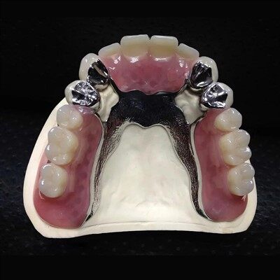 Dental Cocc Metal Framework