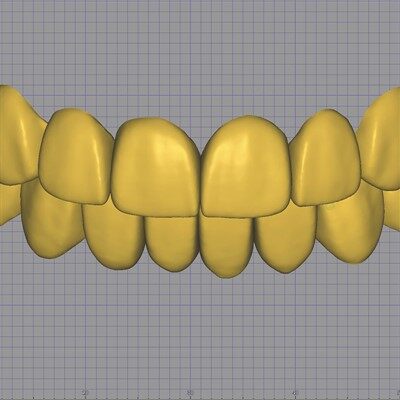 Tandvård Digital Mutilunit Facett Design