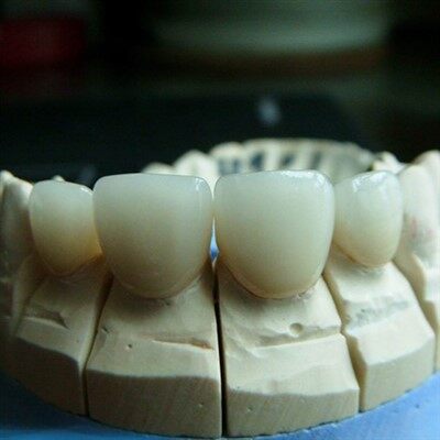 Dental Emax Press Porcelain Crown