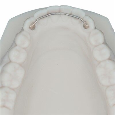 Dental Fixed Lingual Bonded Retainer