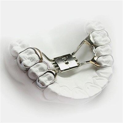 歯科固定された急速な口蓋エキスパンダー