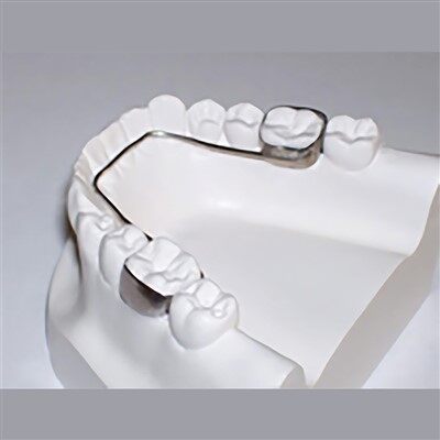 Dental Fixed Space Maintainer