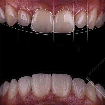 Dental Gingival Gum digital design