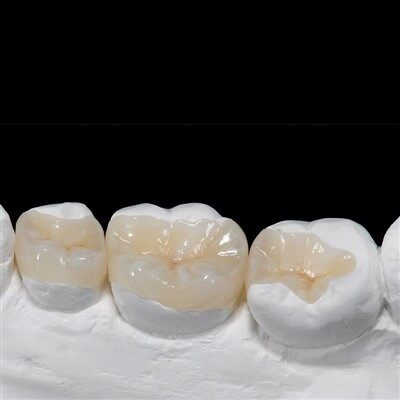 Cov Khoom Noj Hniav Resin raws li Composite