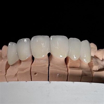 Vương miện màu sắc đa lớp trong suốt trong suốt