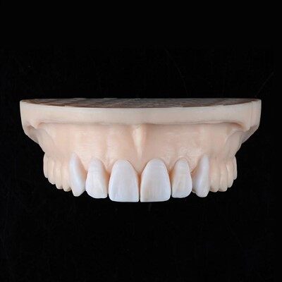 Kev Kho Hniav Veneer Wax thiab kuaj xyuas