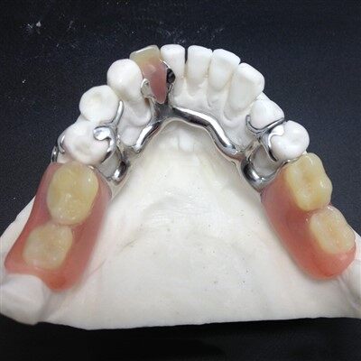 Tannfrumur málmgrindar