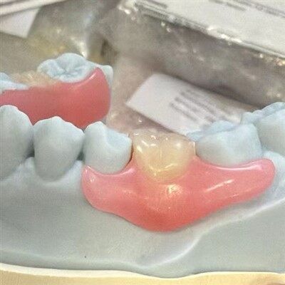 Sveigjanlegt málmplast sem ekki er málm