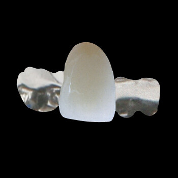 Framtennur Pfm Maryland Bridge