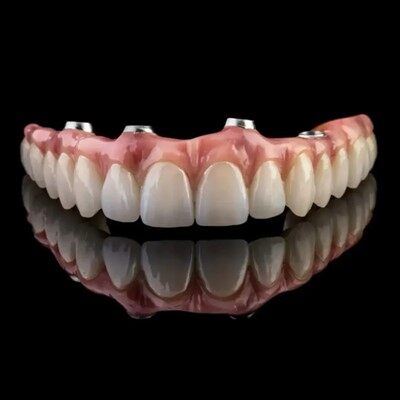 Full Bog tímabundin brú Malong ígræðsla