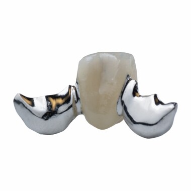 Stakur málmvængur PFM Maryland Bridge