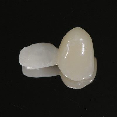 Single Zirconium Wing Pfz Maryland Bridge