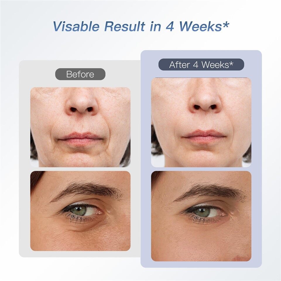 Face Tightening Machine At Home suppliers