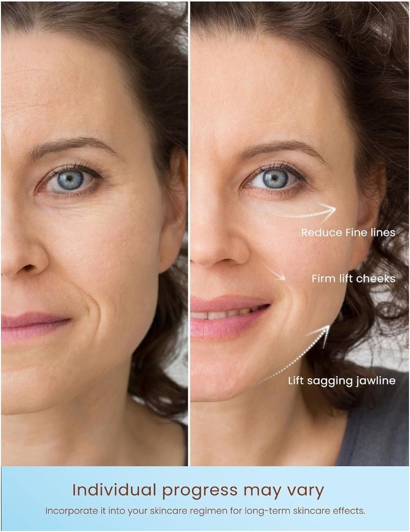 High-Frequency Ultra-Pulse Beauty Device high quality