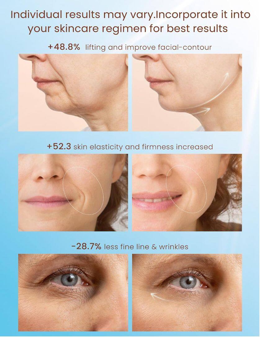 Augstas-Frequency Ultra-Impulss skaistumkopšanas ierīce